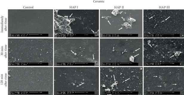 https://cdn.ncbi.nlm.nih.gov/pmc/blobs/fa0c/7222588/5d33e31acd43/SCANNING2020-6065739.007.jpg
