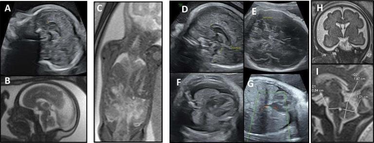 https://cdn.ncbi.nlm.nih.gov/pmc/blobs/fa0d/11420740/7d50c5dcca3c/jmg-2024-109854f02.jpg