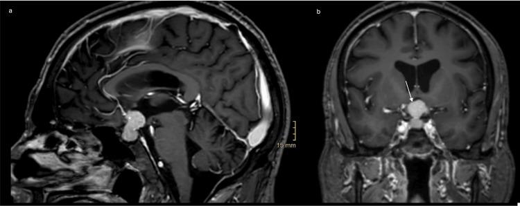 https://cdn.ncbi.nlm.nih.gov/pmc/blobs/fa0d/12357489/24cb573d31c4/cureus-0017-00000088146-i02.jpg