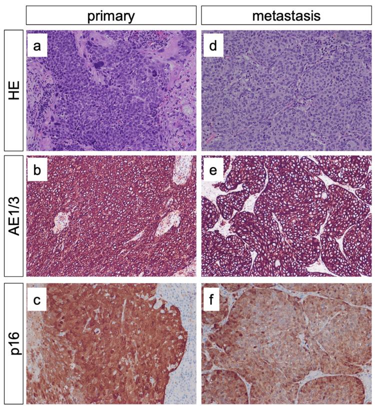https://cdn.ncbi.nlm.nih.gov/pmc/blobs/fa0d/12357489/80ad6aa53b80/cureus-0017-00000088146-i06.jpg