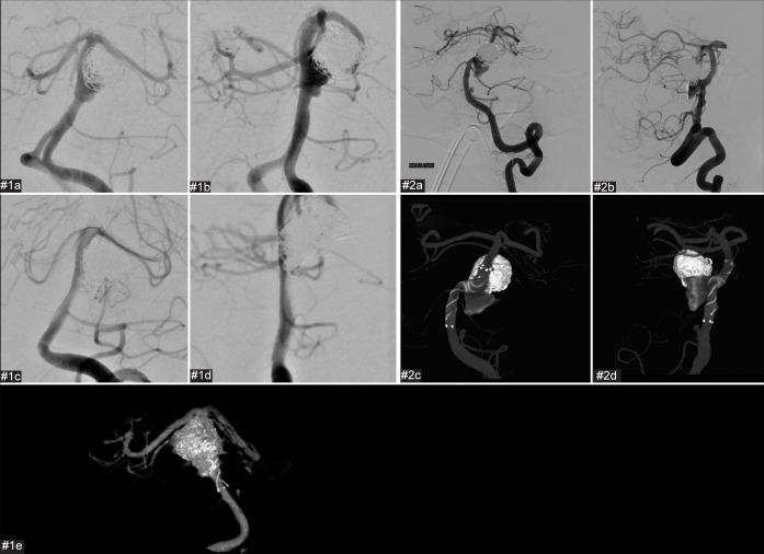 https://cdn.ncbi.nlm.nih.gov/pmc/blobs/fa17/9899459/a94ab70ee9fc/SNI-14-23-g003.jpg