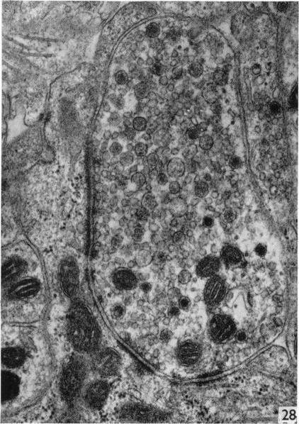 https://cdn.ncbi.nlm.nih.gov/pmc/blobs/fa1c/1271115/06262f44c482/janat00323-0088-c.jpg