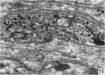https://cdn.ncbi.nlm.nih.gov/pmc/blobs/fa1c/1271115/074e6374a9fe/janat00323-0082-b.jpg