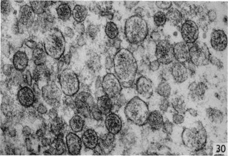 https://cdn.ncbi.nlm.nih.gov/pmc/blobs/fa1c/1271115/b5c0cd892c72/janat00323-0088-e.jpg