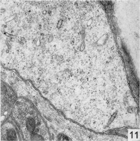 https://cdn.ncbi.nlm.nih.gov/pmc/blobs/fa1c/1271115/c38513ee669a/janat00323-0080-c.jpg