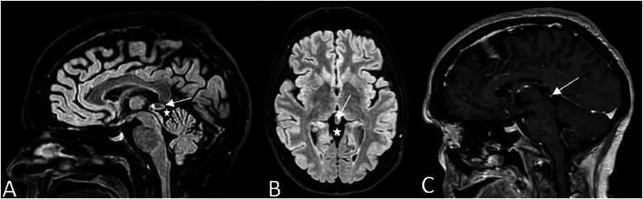 https://cdn.ncbi.nlm.nih.gov/pmc/blobs/fa23/11700279/ed6ea150603a/gr2.jpg