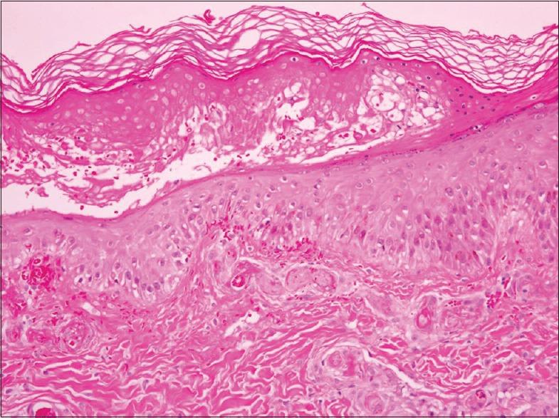 https://cdn.ncbi.nlm.nih.gov/pmc/blobs/fa29/6196709/760f56742aa5/SJMMS-6-104-g003.jpg