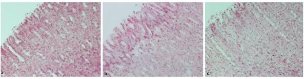 https://cdn.ncbi.nlm.nih.gov/pmc/blobs/fa2e/7216028/b9aa755ed523/jccm-06-100-g001.jpg