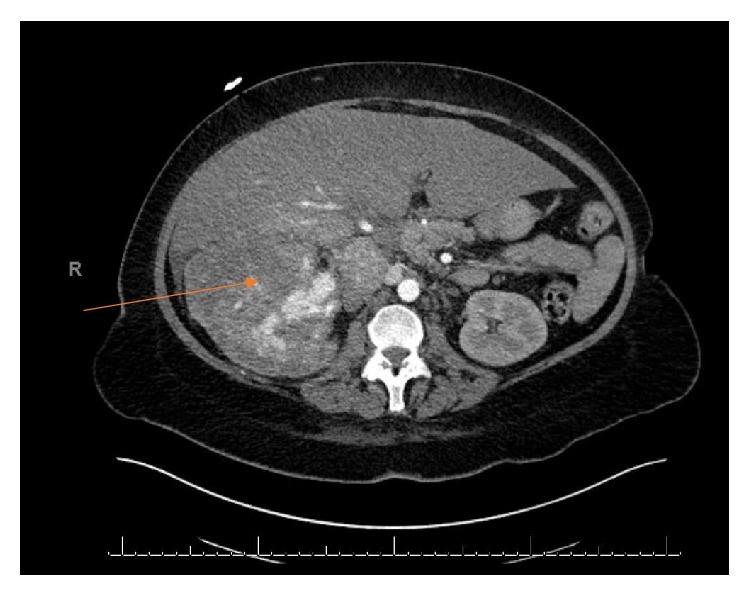 https://cdn.ncbi.nlm.nih.gov/pmc/blobs/fa34/6437729/4cb7c03a91ef/CRIU2019-7102504.001.jpg