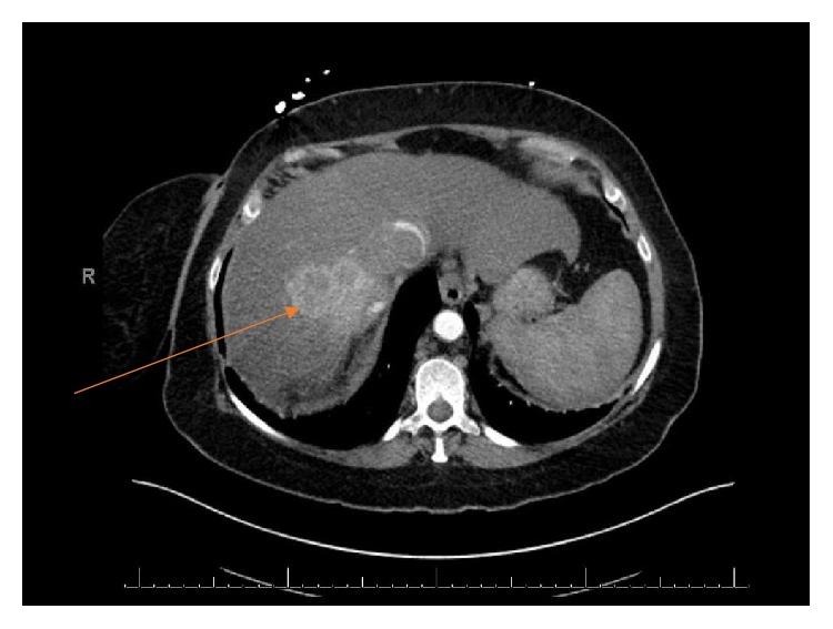 https://cdn.ncbi.nlm.nih.gov/pmc/blobs/fa34/6437729/ac54609d06f3/CRIU2019-7102504.002.jpg