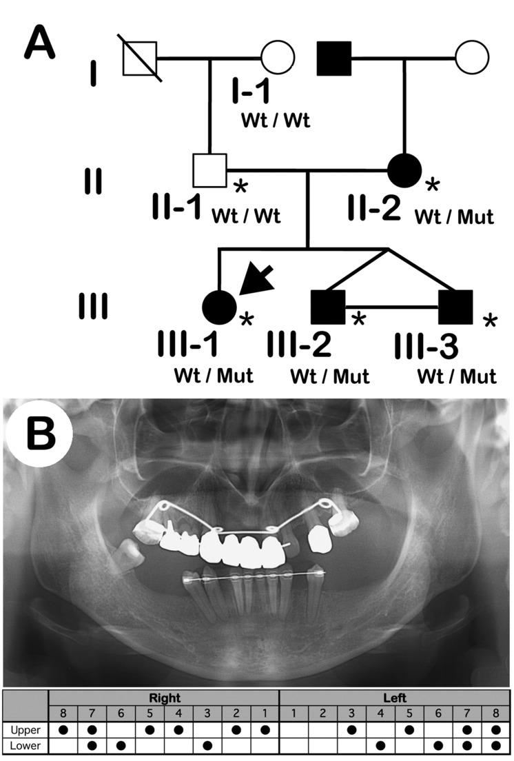 https://cdn.ncbi.nlm.nih.gov/pmc/blobs/fa3b/4451150/336eb30d4681/pone.0128227.g001.jpg