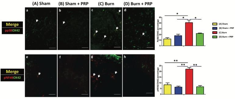 https://cdn.ncbi.nlm.nih.gov/pmc/blobs/fa42/5820853/0229e7249266/ijmsv15p0238g004.jpg