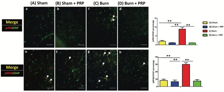 https://cdn.ncbi.nlm.nih.gov/pmc/blobs/fa42/5820853/15a7ad27961c/ijmsv15p0238g006.jpg