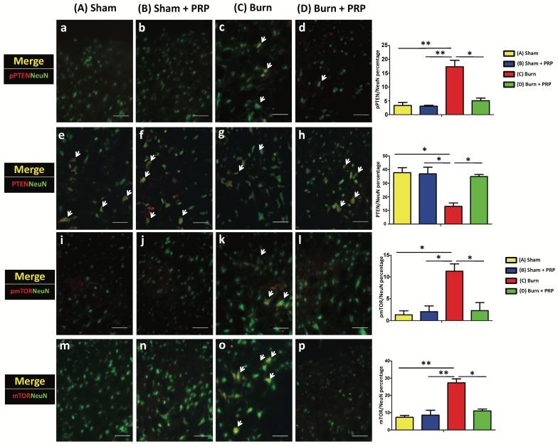 https://cdn.ncbi.nlm.nih.gov/pmc/blobs/fa42/5820853/24fb17d647bd/ijmsv15p0238g003.jpg