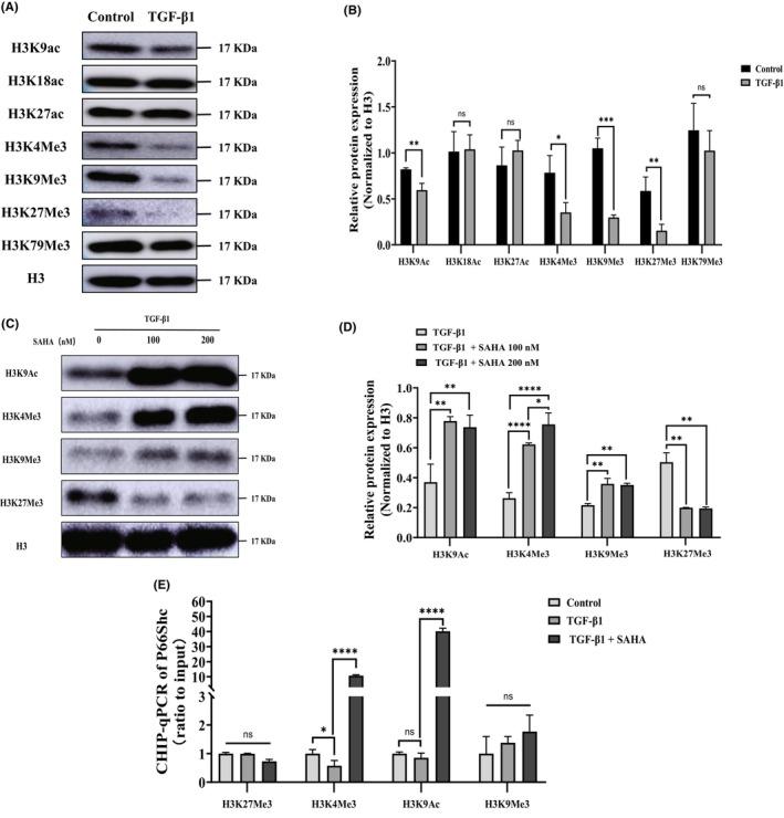 https://cdn.ncbi.nlm.nih.gov/pmc/blobs/fa51/11702475/d4bd573d3cc6/AGM2-7-790-g003.jpg