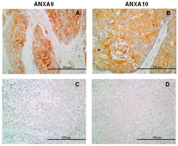 https://cdn.ncbi.nlm.nih.gov/pmc/blobs/fa5b/6406441/726885292337/jcm-08-00229-g002.jpg