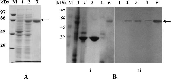 https://cdn.ncbi.nlm.nih.gov/pmc/blobs/fa5d/4000049/0edb583703bd/1743-422X-11-53-2.jpg