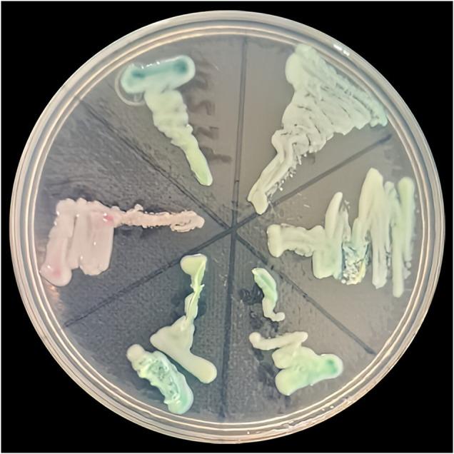 https://cdn.ncbi.nlm.nih.gov/pmc/blobs/fa5f/11760688/c24b6b30d644/JDV-39-377-g003.jpg