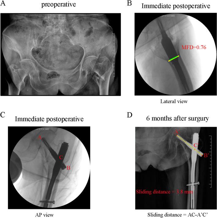 https://cdn.ncbi.nlm.nih.gov/pmc/blobs/fa60/9972673/5472013b1ddc/12891_2023_6213_Fig4_HTML.jpg
