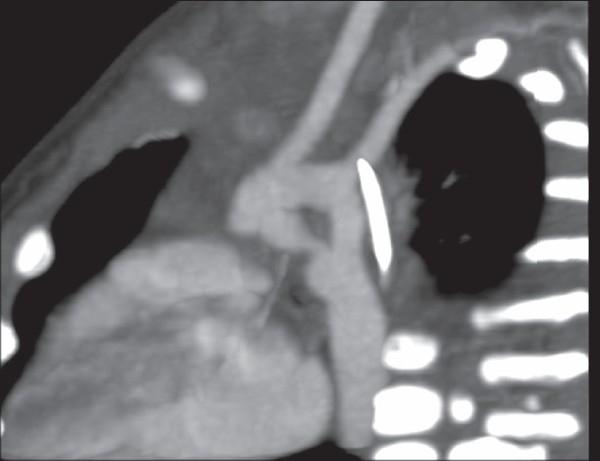 https://cdn.ncbi.nlm.nih.gov/pmc/blobs/fa74/2905536/694d22941327/JIAPS-14-70-g002.jpg