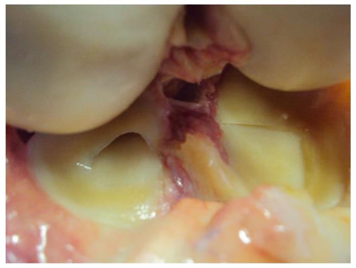 https://cdn.ncbi.nlm.nih.gov/pmc/blobs/fa7d/10855111/531894599159/diagnostics-14-00305-g002.jpg