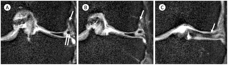 https://cdn.ncbi.nlm.nih.gov/pmc/blobs/fa82/9514523/4d0eca0fa9d2/jksr-83-582-g008.jpg