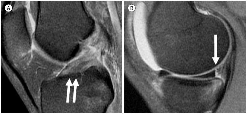 https://cdn.ncbi.nlm.nih.gov/pmc/blobs/fa82/9514523/b1c3da4e74c5/jksr-83-582-g020.jpg