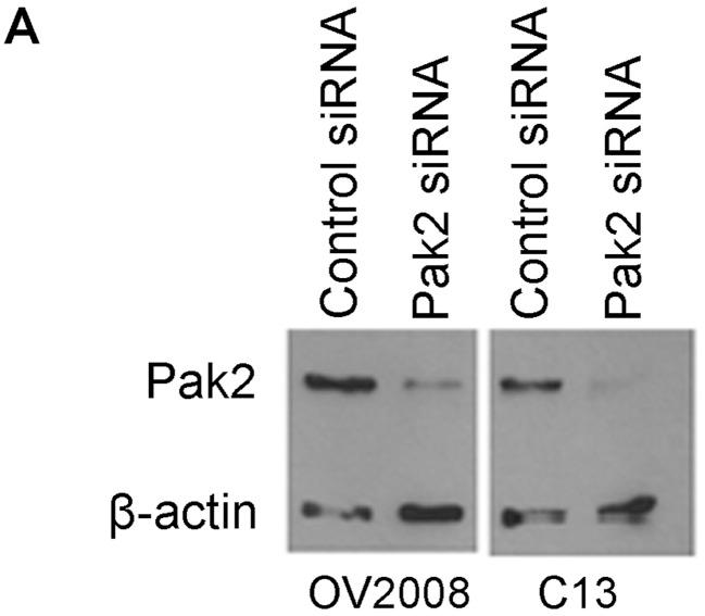 https://cdn.ncbi.nlm.nih.gov/pmc/blobs/fa85/4151804/582eb47a1dc2/IJO-45-04-1401-g16.jpg