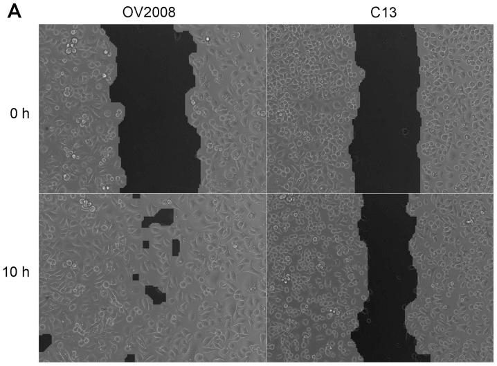 https://cdn.ncbi.nlm.nih.gov/pmc/blobs/fa85/4151804/df94d5b55ab3/IJO-45-04-1401-g02.jpg