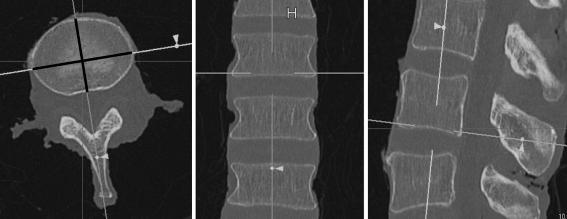 https://cdn.ncbi.nlm.nih.gov/pmc/blobs/fa8b/2900026/683f1efe3d23/586_2010_1326_Fig2_HTML.jpg