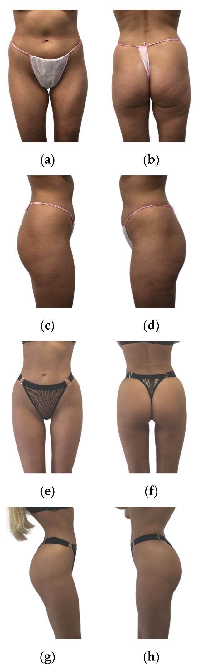 https://cdn.ncbi.nlm.nih.gov/pmc/blobs/fa8d/10970832/b297557cd391/jcm-13-01526-g006.jpg