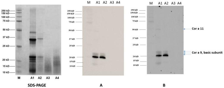 https://cdn.ncbi.nlm.nih.gov/pmc/blobs/fa92/8875159/95beb79e3887/nutrients-14-00874-g005a.jpg