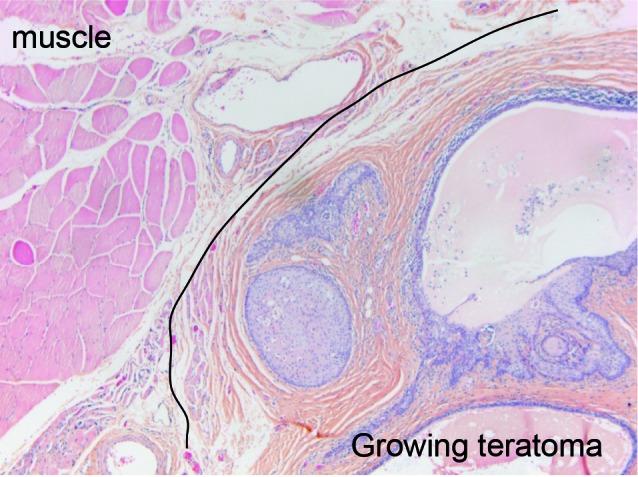 https://cdn.ncbi.nlm.nih.gov/pmc/blobs/fa99/4286866/3e3939dca3b3/FVVinObGyn-6-250-253-g002.jpg