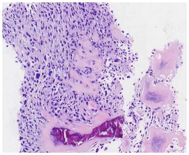 https://cdn.ncbi.nlm.nih.gov/pmc/blobs/fa9e/12373421/f35fa2b3ab1e/ol-30-04-15231-g06.jpg