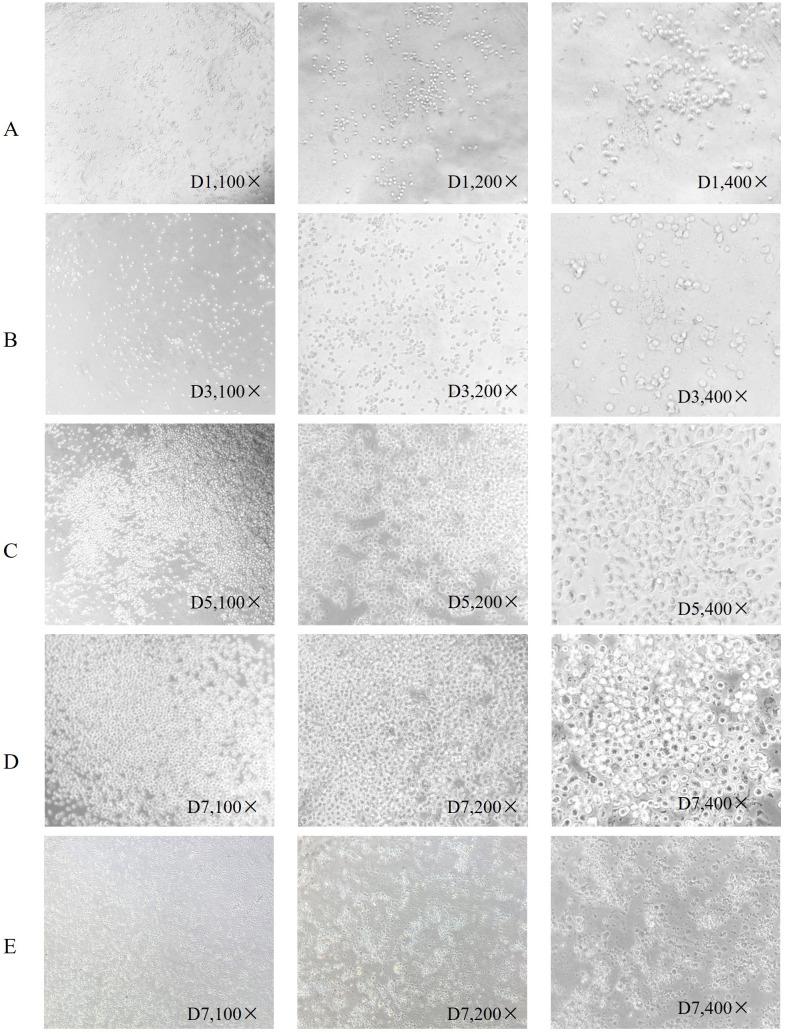 https://cdn.ncbi.nlm.nih.gov/pmc/blobs/fab5/11570797/de28034f0eed/fimmu-15-1473145-g001.jpg