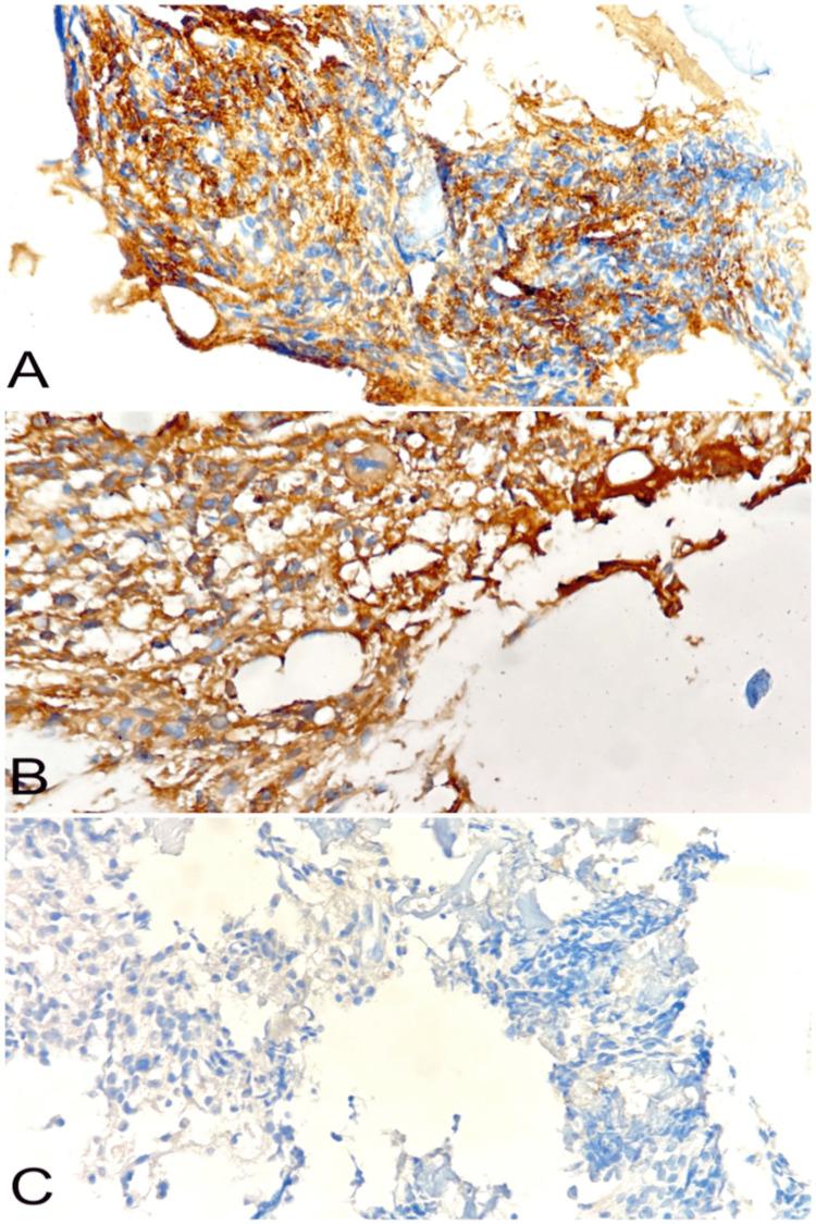 https://cdn.ncbi.nlm.nih.gov/pmc/blobs/fab8/12168623/212128a5ca94/cureus-0017-00000084203-i02.jpg