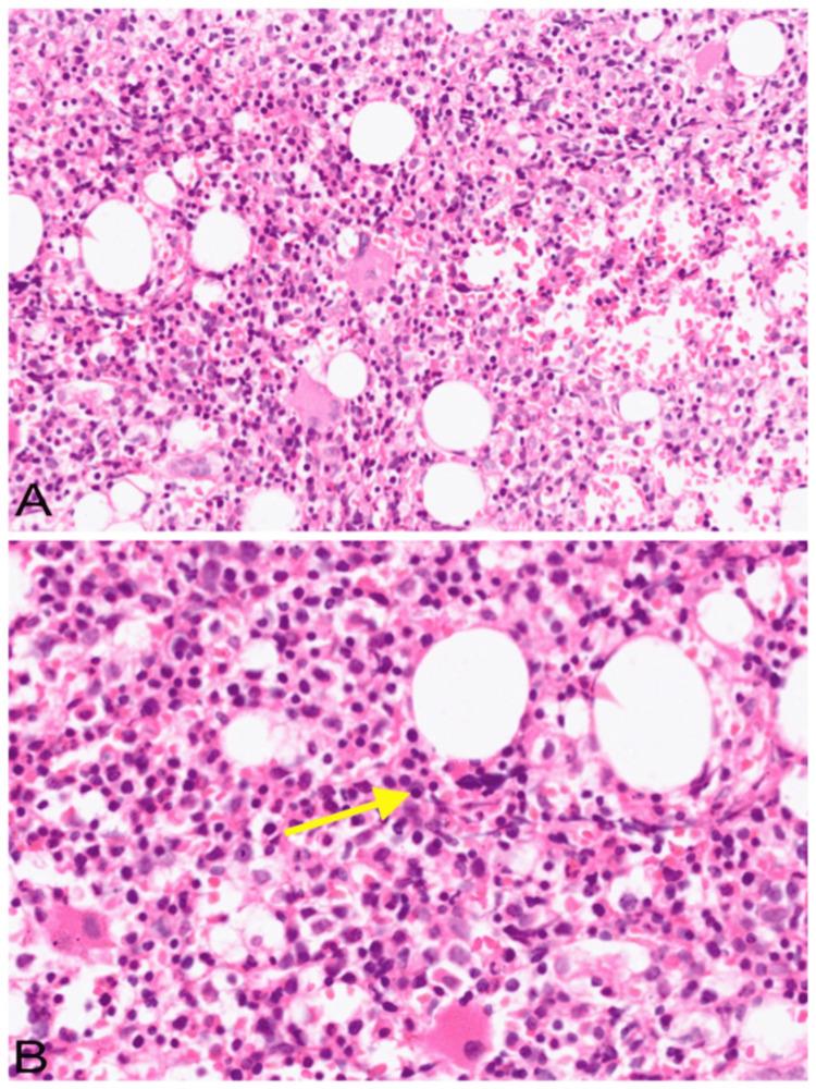 https://cdn.ncbi.nlm.nih.gov/pmc/blobs/fab8/12168623/9fd01961a647/cureus-0017-00000084203-i01.jpg