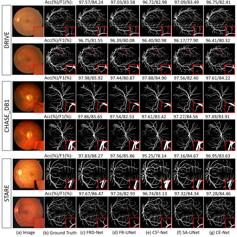 https://cdn.ncbi.nlm.nih.gov/pmc/blobs/fabd/11161363/5544b8a6d241/boe-15-5-3344-g008.jpg