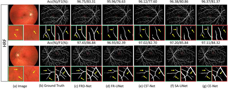 https://cdn.ncbi.nlm.nih.gov/pmc/blobs/fabd/11161363/b70b6ed27aa1/boe-15-5-3344-g009.jpg