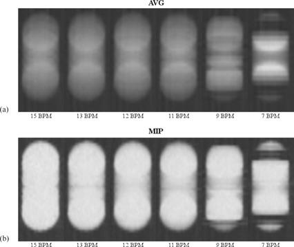 https://cdn.ncbi.nlm.nih.gov/pmc/blobs/fabe/5690122/36a2834e7d16/ACM2-16-389-g004.jpg