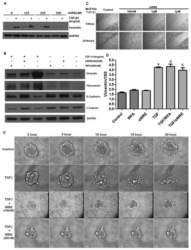 https://cdn.ncbi.nlm.nih.gov/pmc/blobs/fac0/3771884/1433c36aa775/pone.0075069.g004.jpg