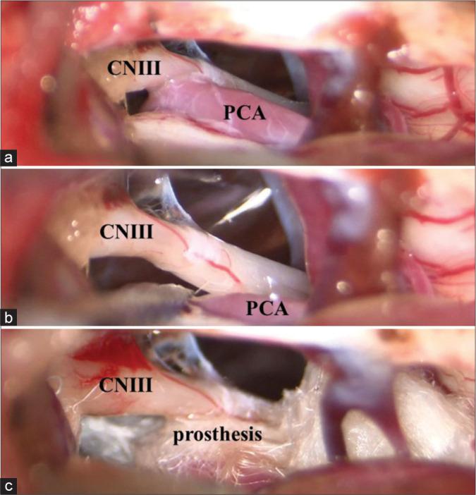 https://cdn.ncbi.nlm.nih.gov/pmc/blobs/fac5/11152531/aef7b75e4ad1/SNI-15-174-g002.jpg