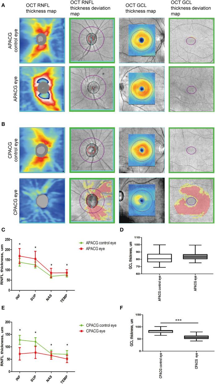 https://cdn.ncbi.nlm.nih.gov/pmc/blobs/fac7/10073422/341765b880e4/fneur-14-1091697-g0001.jpg