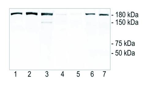https://cdn.ncbi.nlm.nih.gov/pmc/blobs/fac7/2999438/b78cf9107006/f08_01.jpg