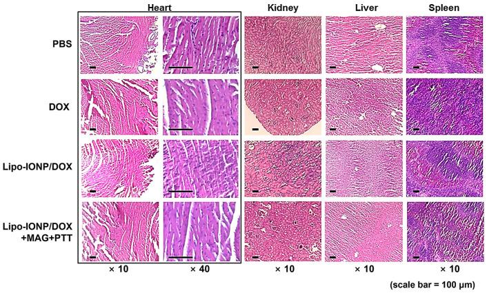 https://cdn.ncbi.nlm.nih.gov/pmc/blobs/facf/9860715/4c09be1fd4b7/pharmaceutics-15-00292-g010.jpg