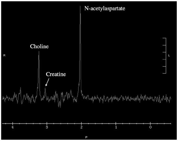 https://cdn.ncbi.nlm.nih.gov/pmc/blobs/fad9/9909053/42ebb33c2f75/10.1177_23247096231154438-fig1.jpg