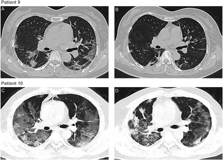 https://cdn.ncbi.nlm.nih.gov/pmc/blobs/fadb/7196837/6615a5c8a884/pnas.2004168117fig01.jpg