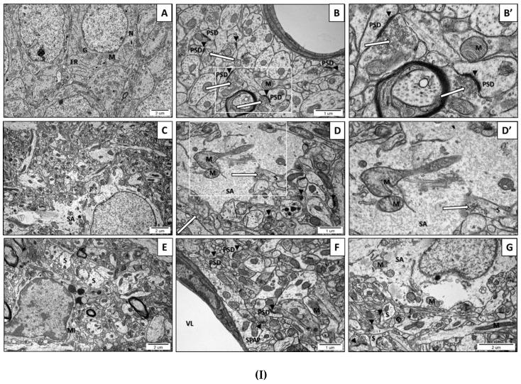 https://cdn.ncbi.nlm.nih.gov/pmc/blobs/fadc/7279050/0f9ff83d77ec/ijms-21-03576-g002a.jpg