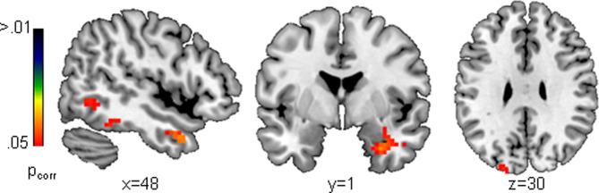 https://cdn.ncbi.nlm.nih.gov/pmc/blobs/fae0/10325848/8ef6ea62585b/S003329172200068X_fig3.jpg