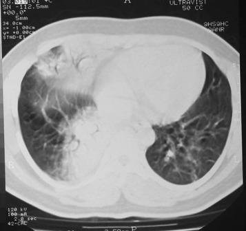 https://cdn.ncbi.nlm.nih.gov/pmc/blobs/fae6/7094603/9a6e09015886/gr2.jpg